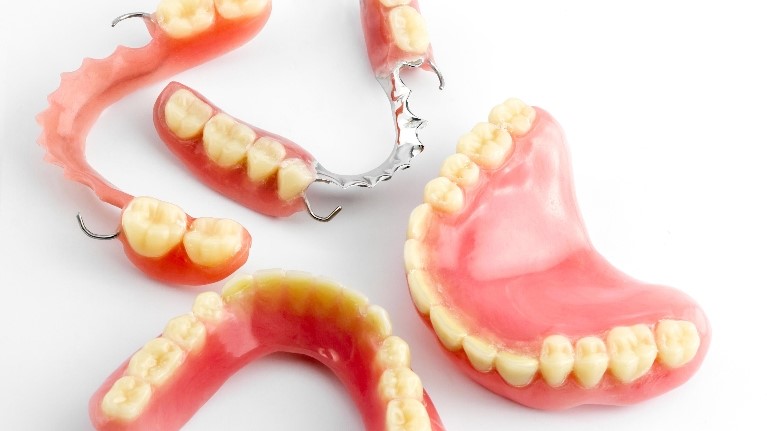 پروتزهای مصنوعی و ایمپلنت های دندانی
