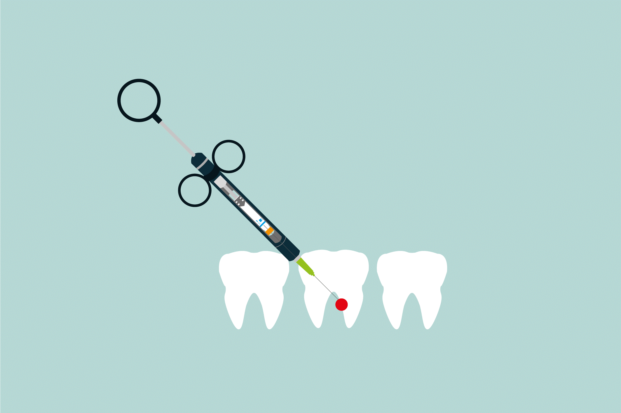 بی حسی موضعی و بیهوشی کامل در دندانپزشکی