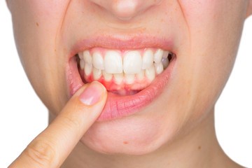 سلامت دهان و دندان در بارداری