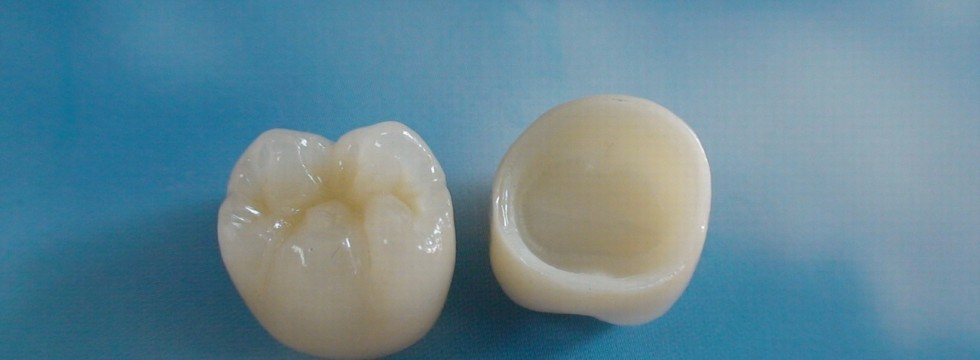 روکشهای دندانی