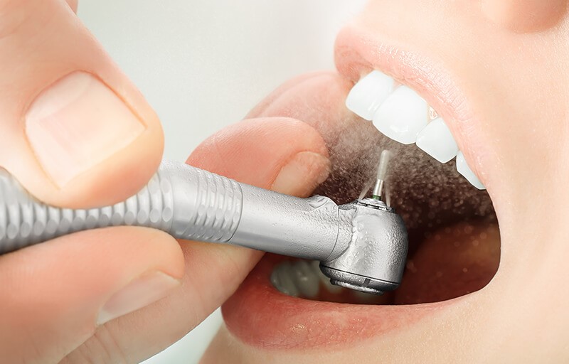 جرمگیری دندان درد دارد؟