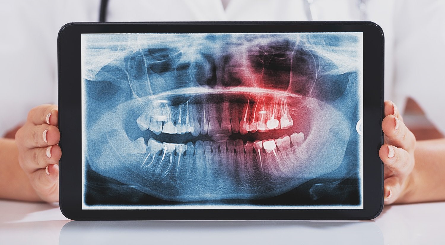 تاثیر کشیدن دندان بر ساختار صورت
