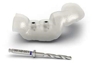 کاربرد راهنمای جراحی در کاشت ایمپلنت های دندانی