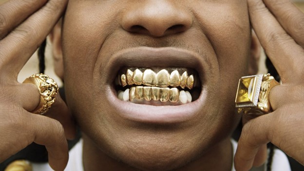 دندان های طلای دائمی