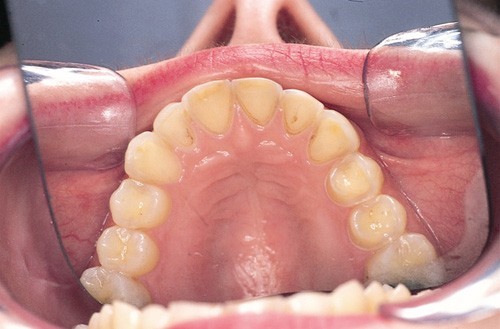  اختلالات خوردن و مشکلات دهان و دندان 