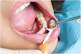 مشکلات شایع بهداشت دهان و دندان در بارداری