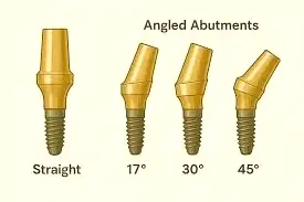 زوایای نامتعارف برای تناسب بهتر