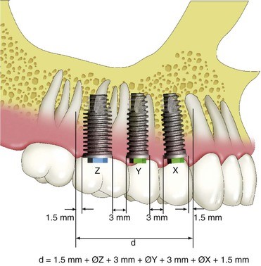 قانون 2/3 چگونه به بیماران کمک می کند؟