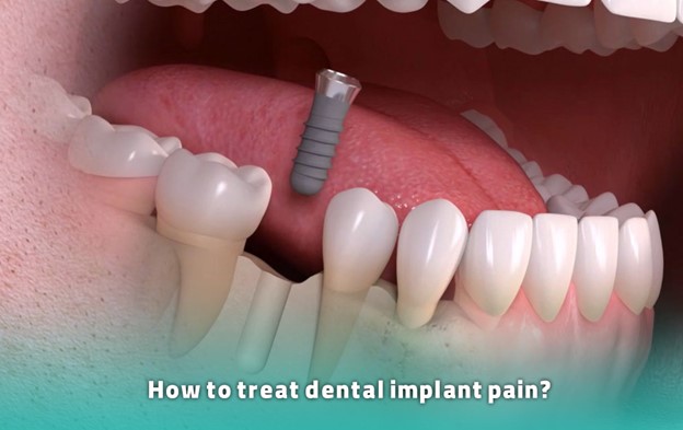 اگر ایمپلنت دندانی من پس از دو هفته هنوز درد داشته باشد، به چه معناست؟