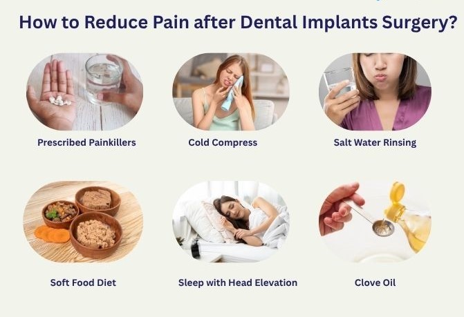 نکات ما در مورد مشکلات پس از جراحی ایمپلنت دندان